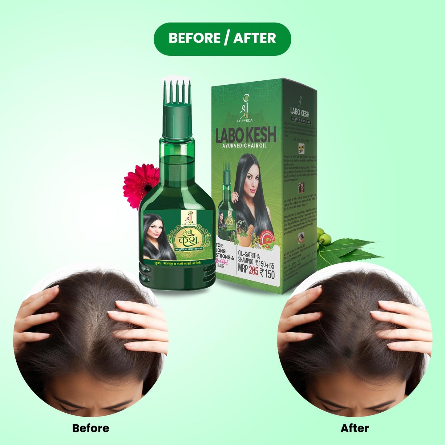Shree Ayu-Veda Labo kesh Ayurvedic Hair Oil